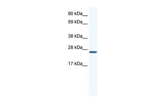 BMAL1 Antibody in Western Blot (WB)