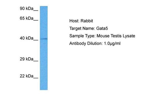 GATA5 Antibody in Western Blot (WB)