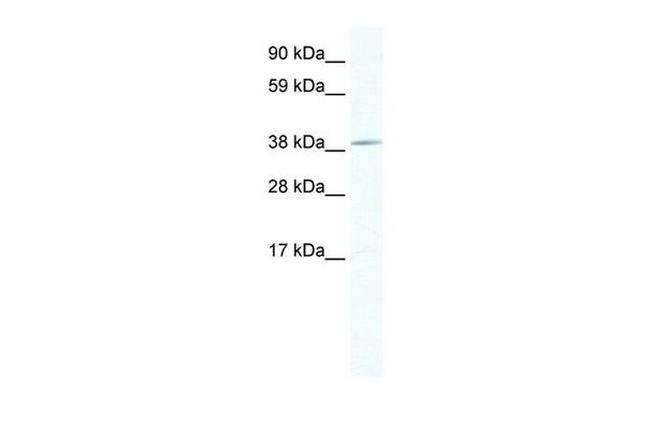 TOB1 Antibody in Western Blot (WB)