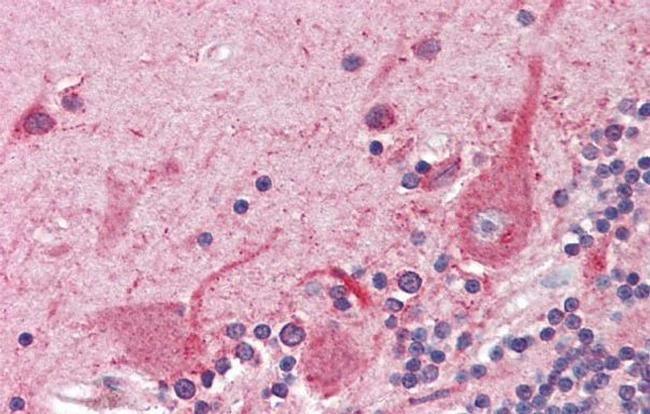 ATF4 Antibody in Immunohistochemistry (IHC)