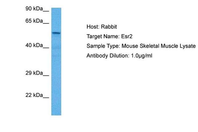 Estrogen Receptor beta Antibody in Western Blot (WB)