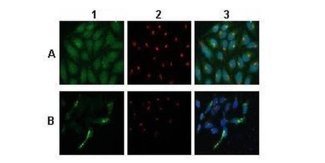 ATP6V0A1 Antibody in Immunocytochemistry (ICC/IF)