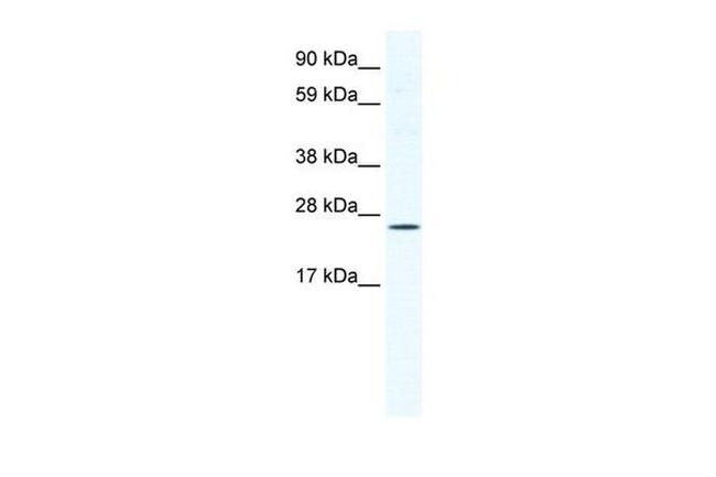 BRF1 Antibody in Western Blot (WB)