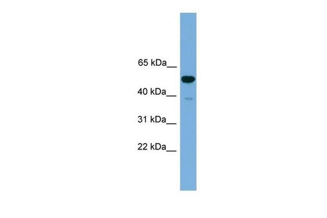 ONECUT3 Antibody in Western Blot (WB)