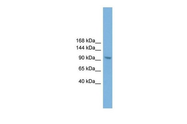 ZHX3 Antibody in Western Blot (WB)