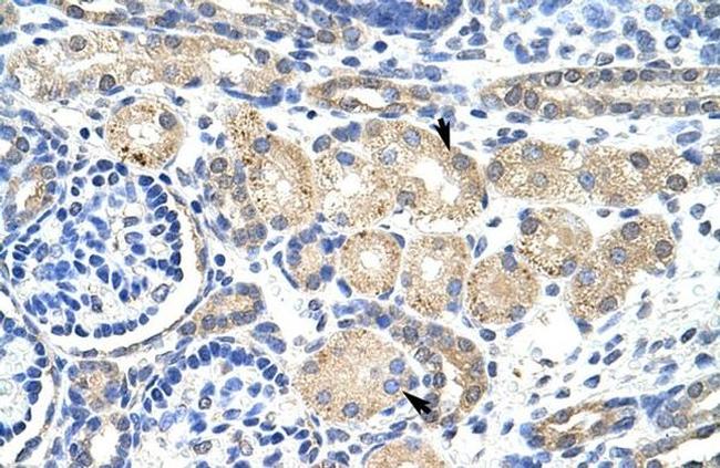 KVbeta2 (KCNAB2) Antibody in Immunohistochemistry (IHC)