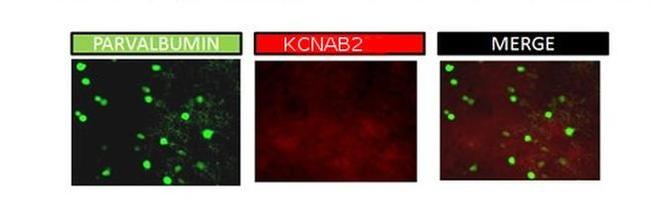 KVbeta2 (KCNAB2) Antibody in Immunohistochemistry (IHC)