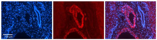 ZFP36L1 Antibody in Immunohistochemistry (Paraffin) (IHC (P))