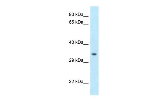 HOXC11 Antibody in Western Blot (WB)