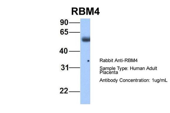 RBM4 Antibody in Western Blot (WB)