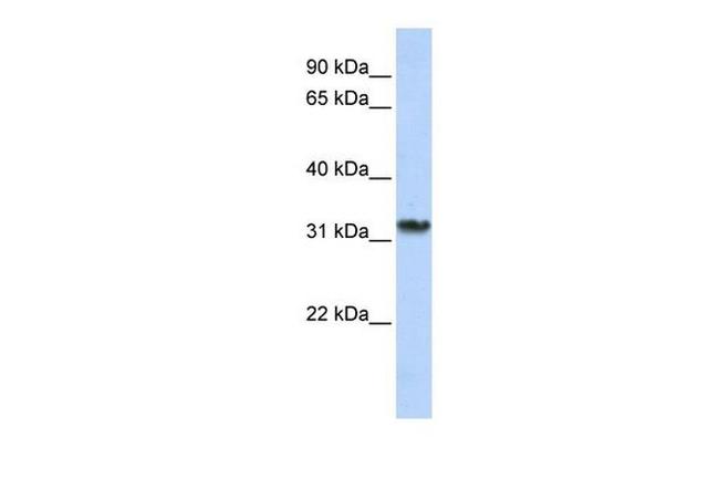 SMNDC1 Antibody in Western Blot (WB)