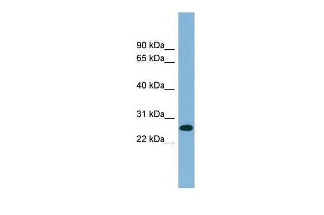 SRrp35 Antibody in Western Blot (WB)