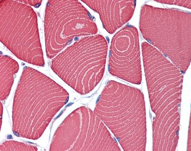 MYH7 Antibody in Immunohistochemistry (IHC)