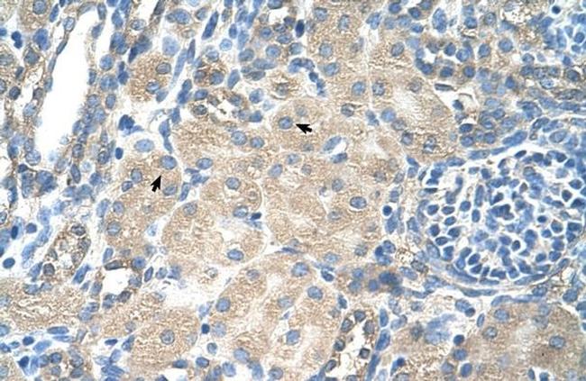 SLC13A3 Antibody in Immunohistochemistry (Paraffin) (IHC (P))