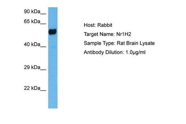 LXR beta Antibody in Western Blot (WB)