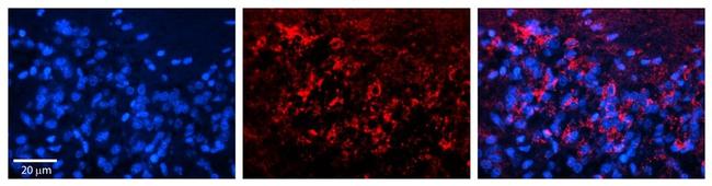 ANT Antibody in Immunohistochemistry (Paraffin) (IHC (P))