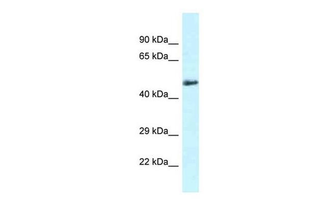 SLC1A4 Antibody in Western Blot (WB)