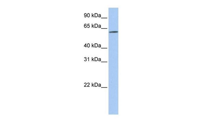 SLC22A14 Antibody in Western Blot (WB)