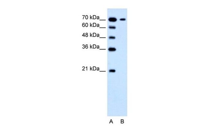 SLC5A4 Antibody in Western Blot (WB)