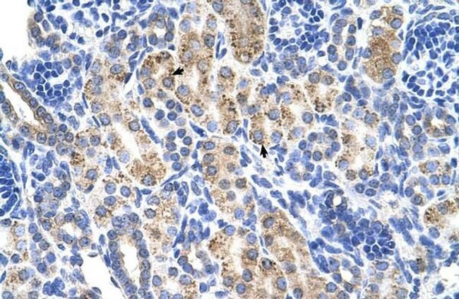 ALDH3A2 Antibody in Immunocytochemistry (ICC/IF)