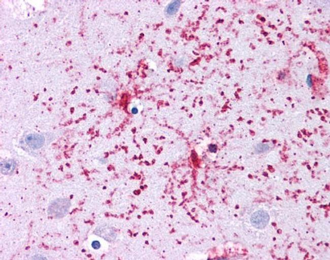 GluD1 Antibody in Immunohistochemistry (IHC)