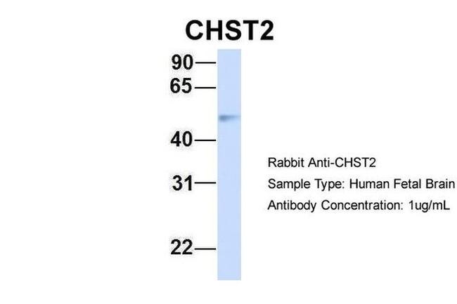 CHST2 Antibody in Western Blot (WB)