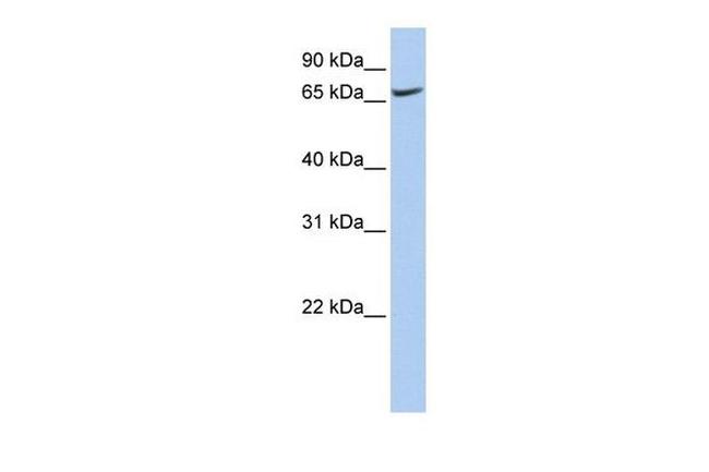 ATP6V0A1 Antibody in Western Blot (WB)