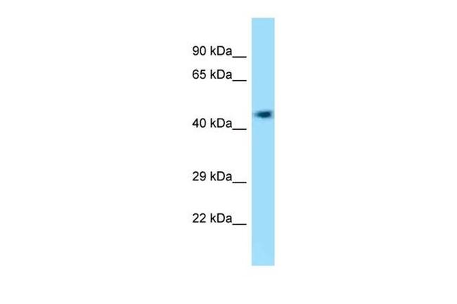 EFCAB14 Antibody in Western Blot (WB)