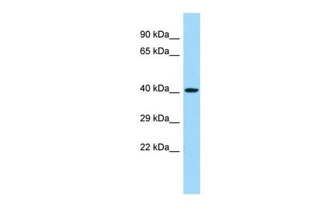 CHST11 Antibody in Western Blot (WB)