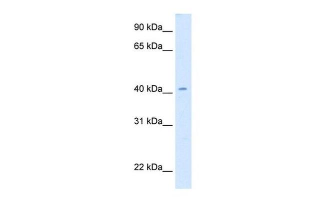 CAD Antibody in Western Blot (WB)