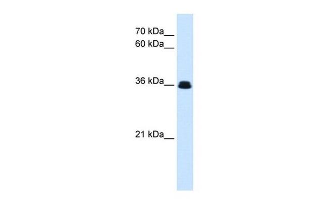 eve Antibody in Western Blot (WB)