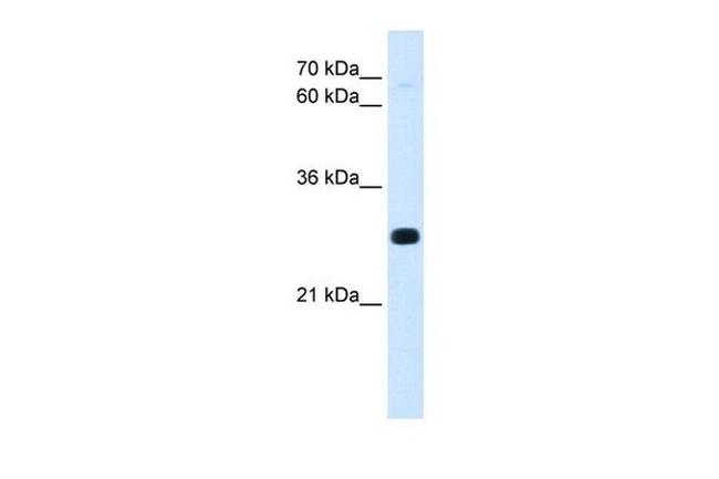 Antp Antibody in Western Blot (WB)