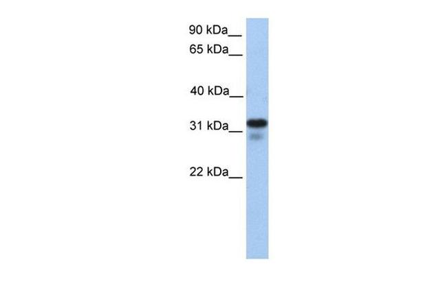 HS3ST6 Antibody in Western Blot (WB)