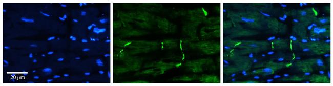 PERP Antibody in Immunocytochemistry (ICC/IF)