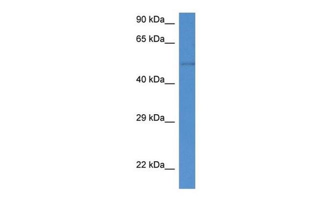 ST6GAL2 Antibody in Western Blot (WB)