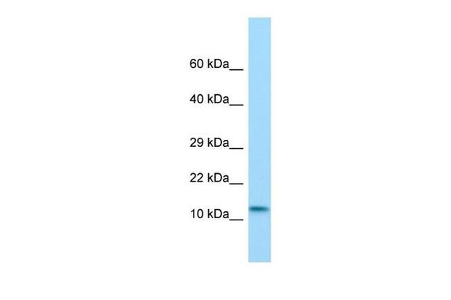 MKL2 Antibody in Western Blot (WB)