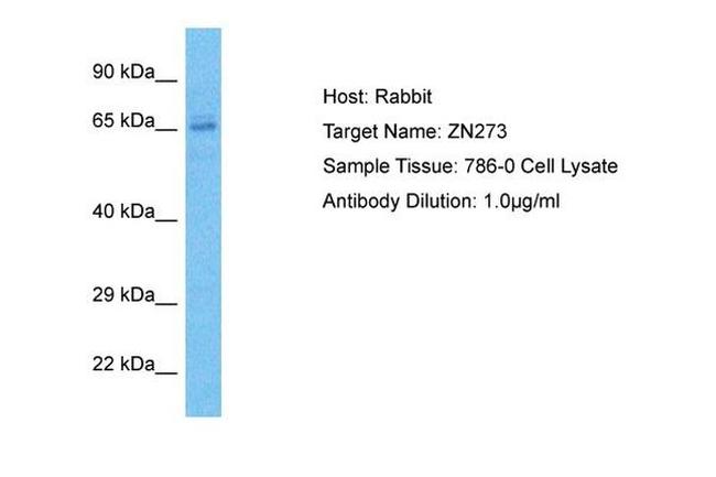 ZNF273 Antibody in Western Blot (WB)