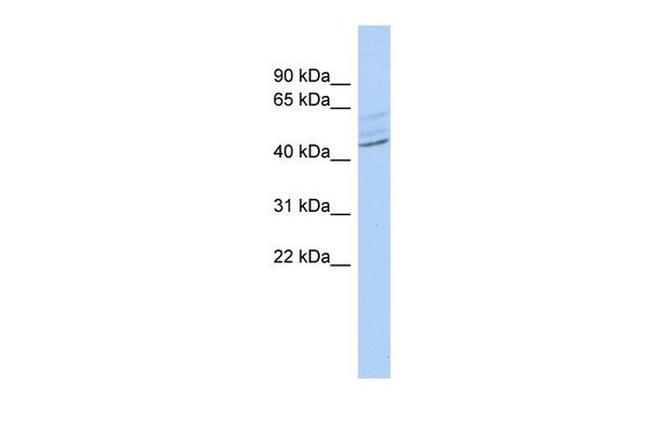 ZMYND12 Antibody in Western Blot (WB)