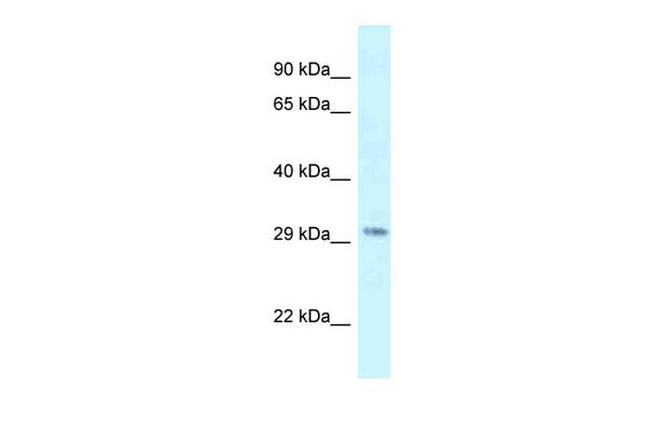 SUV420H1 Antibody in Western Blot (WB)