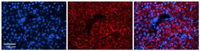 OVCA1 Antibody in Immunocytochemistry (ICC/IF)