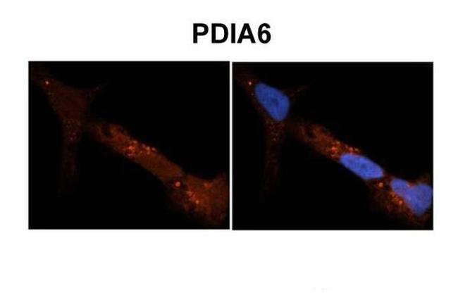 PDIA6 Antibody in Immunohistochemistry (IHC)