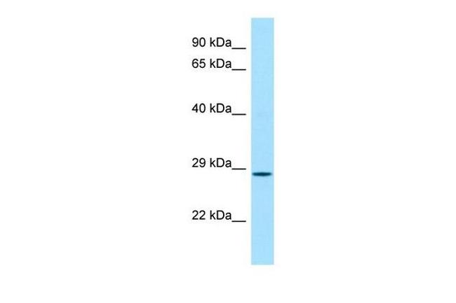 CFDP1 Antibody in Western Blot (WB)