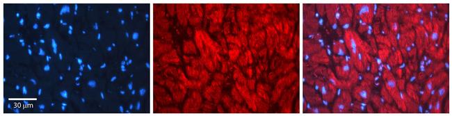 EHD1 Antibody in Immunocytochemistry (ICC/IF)