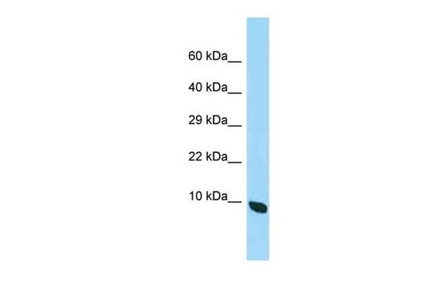 QIL1 Antibody in Western Blot (WB)