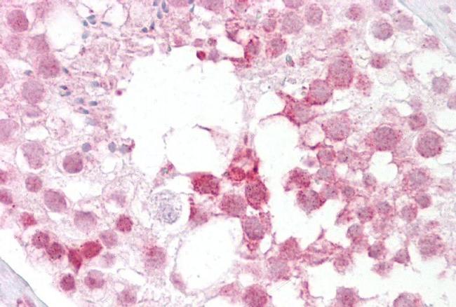 IFT88 Antibody in Immunohistochemistry (IHC)