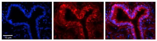 GSR Antibody in Immunohistochemistry (Paraffin) (IHC (P))