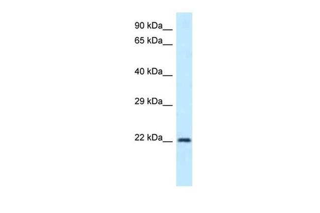 GUK1 Antibody in Western Blot (WB)