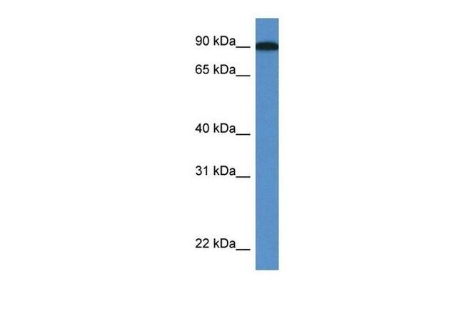 LOXL2 Antibody in Western Blot (WB)