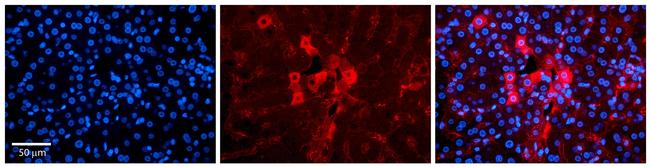 METL5 Antibody in Immunocytochemistry (ICC/IF)