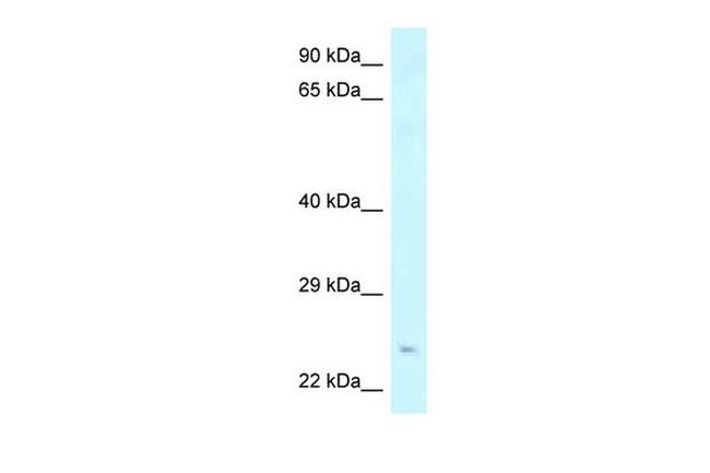 Amisyn Antibody in Western Blot (WB)